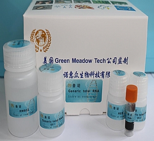 ͨￂRNAȡ Generic Kits for Total RNA Isolation